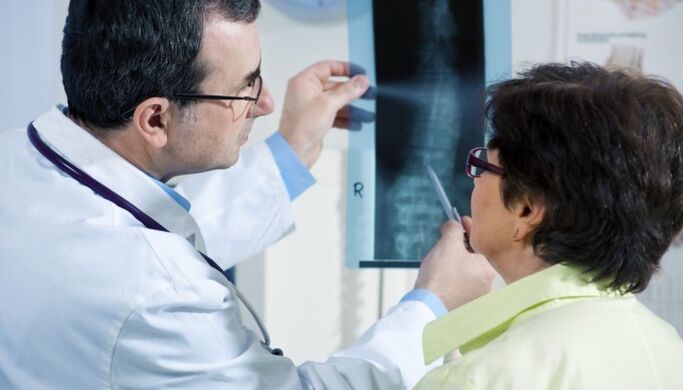 rentgen páteře s osteochondrózou