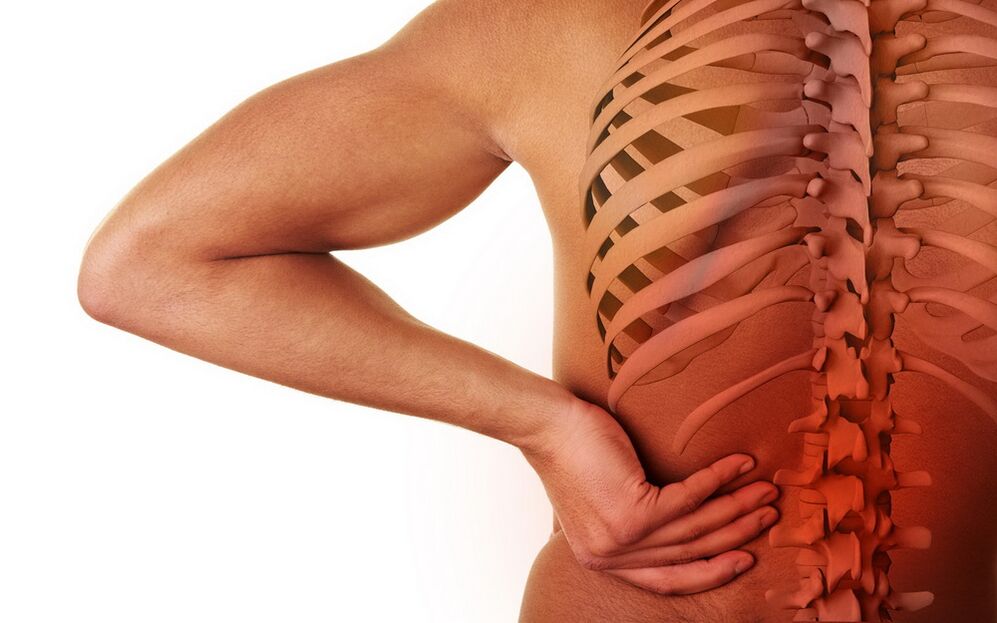 bolest zad způsobená osteochondrózou