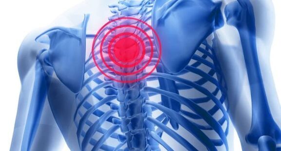 Léčba osteochondrosy hrudní páteře