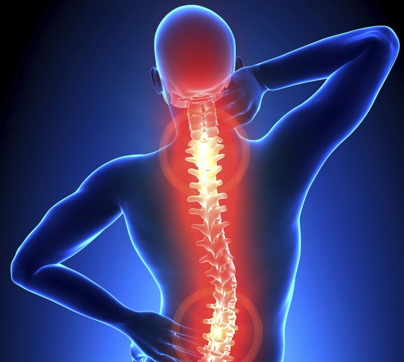 Osteochondroza páteře